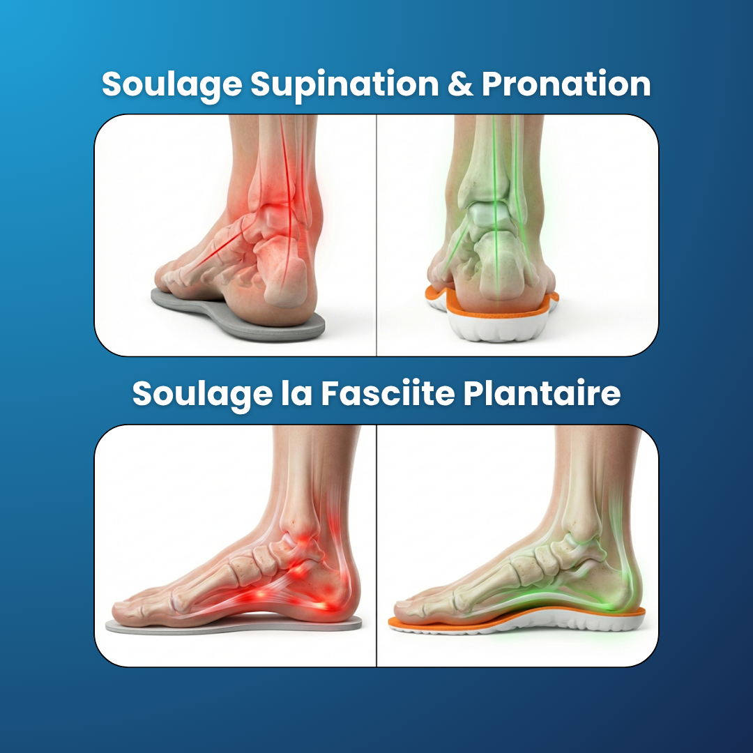 Semelles anti-douleur plantaire