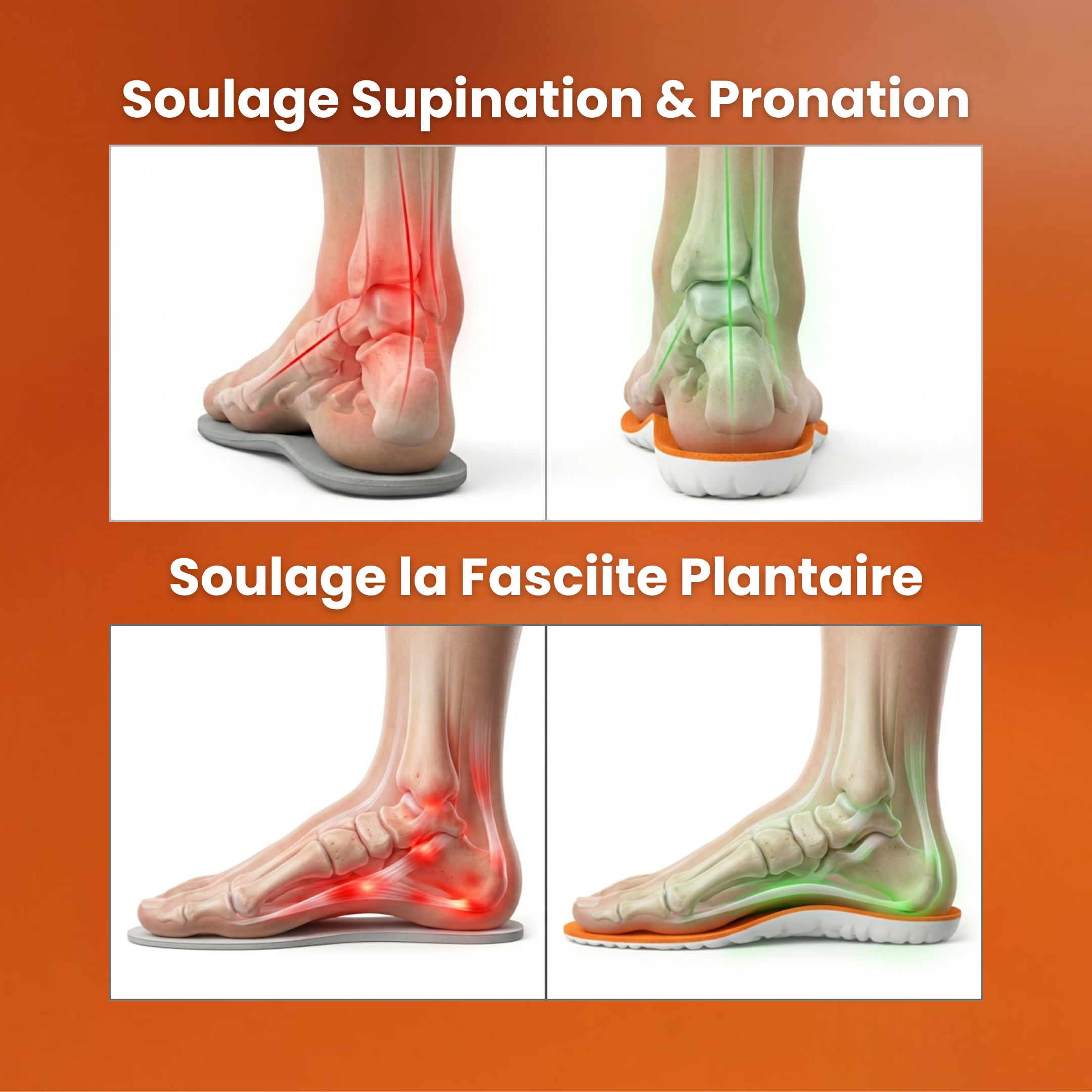 Semelles anti-douleur plantaire