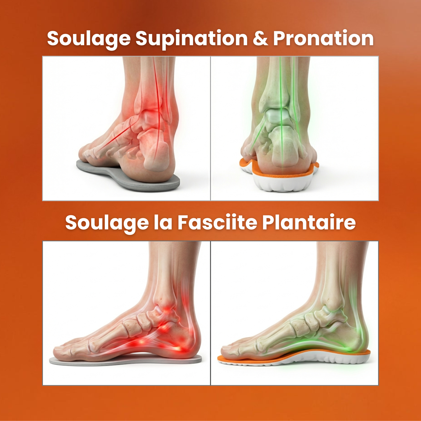 Semelles anti-douleur plantaire